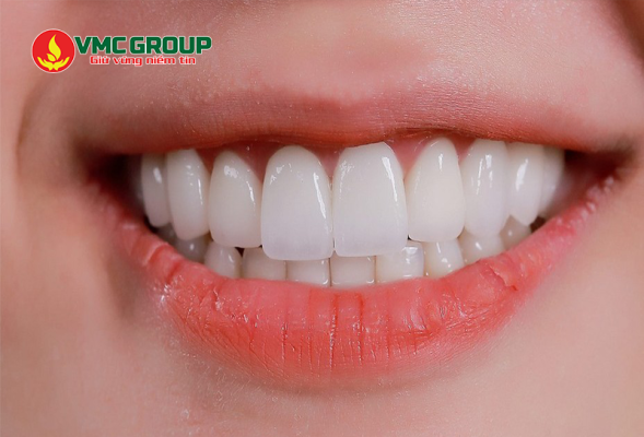 Đường ăn kiêng giúp bảo vệ răng miệng khỏe mạnh